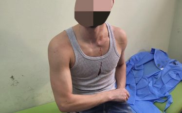 Policia publikon fotografitë e kosovarëve që u sulmuan në Veri